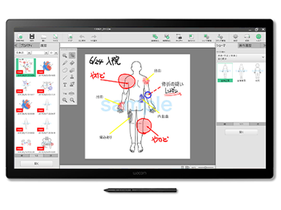 Cintiq 24 メディカルモデル DTK246EK4C/MEDICAL